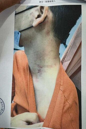 恐怖情人2/親密愛人成殺手! 精神科醫生曝致命警訊:快求助