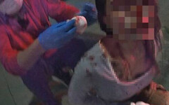 嘉義清晨自小客半路失控猛撞停車 19歲女乘客滿臉鮮血送醫