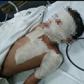 鄰居買小蘇打粉通水管！竟引爆樓下廚房爆炸 9歲男童「毀容恐失明」