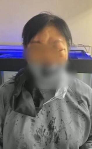 送進看守所！壯保全「痛毆女牙醫濺血」遭羈押禁見