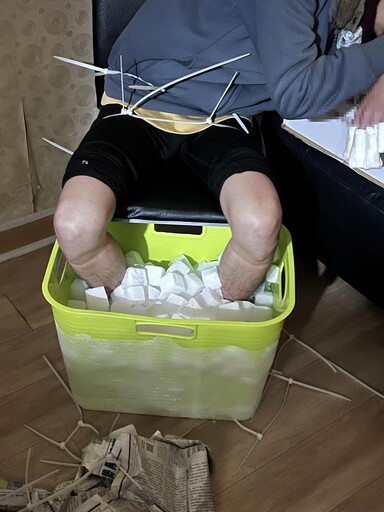 「乾冰凍腳」截肢詐保4100萬!男大生緩刑 共犯判6年
