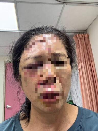 影/路燈基座螺絲成奪命樁！台中10年前男童枉死 苗栗婦頭濺血