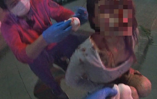 影/嘉義自撞車頭全毀3傷 後座19歲正妹頭破滿臉血