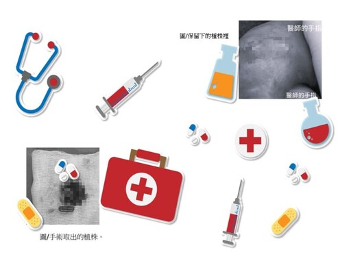 高溫季節男性生殖器感染率攀升！李宗熹:籲維持清潔衛生習慣很重要