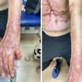瓦斯意外層出不窮 安全用火時刻不鬆懈
