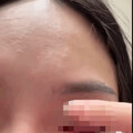 【獨家】新北中和驚傳情暴案！恐怖情人失控爆擊致女方左眼水晶體脫落幾乎失明 中和警火速拘提到案建請聲押禁見