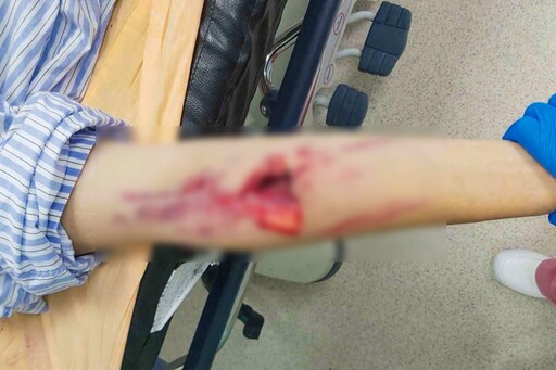 影音/少年騎車自摔脾臟碎裂 彰基整合創傷團隊成功搶救