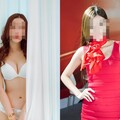 貴婦找名醫打牛奶針昏迷13天未醒 身分疑為「車模界林志玲」