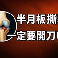 半月板 = 膝蓋避震器！受傷後要復健還是開刀 - 一分鐘健身教室